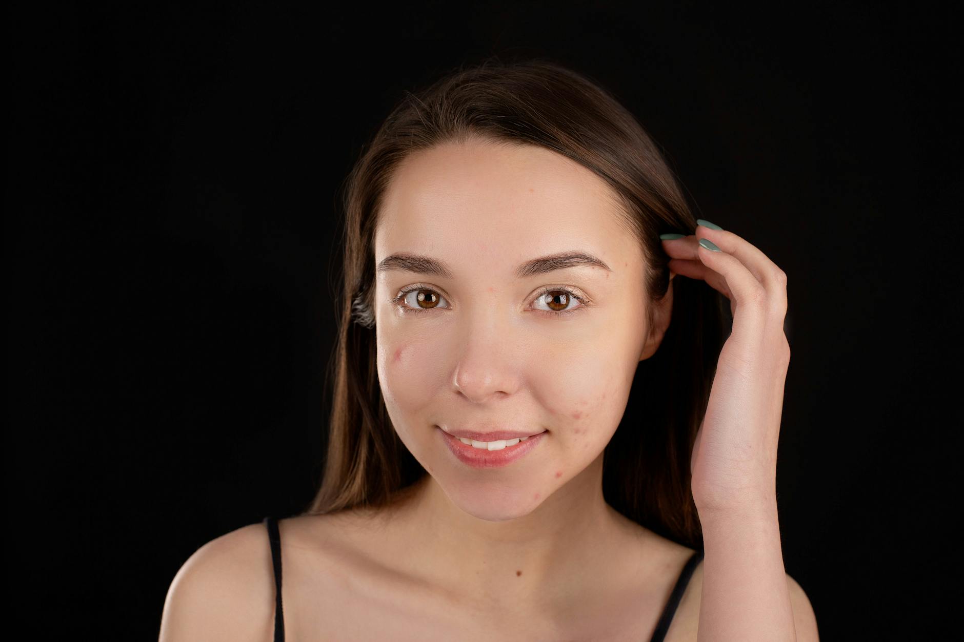 Uśmiechnięta brunetka z trądzikiem na tle czarnego tła